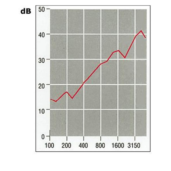 Pannello autoestinguente con finitura fibra di vetro bianca